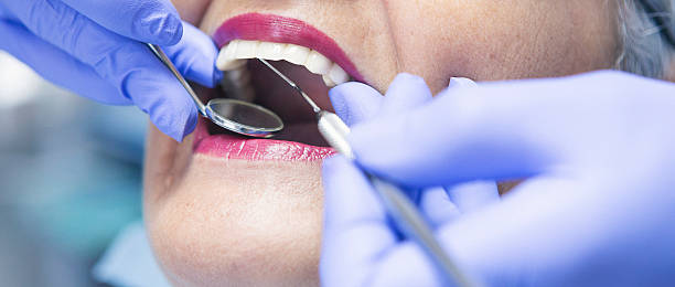 Best Weekend Emergency Dental Services in Tell City, IN